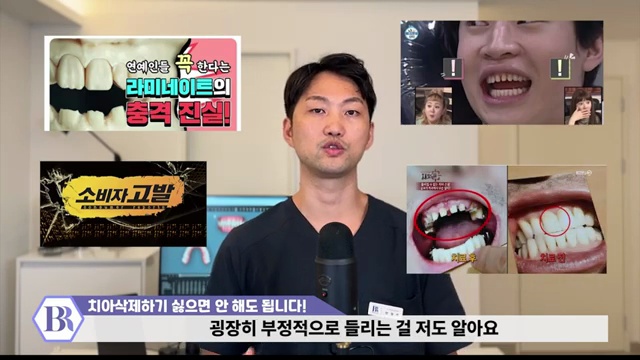치아삭제 원하지 않으면 하지마세요!