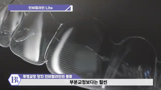 2023년 최신버전) 투명교정 인비절라인 종류 전부 알려드립니다! #인비절라인 #치아교정 #invisalign