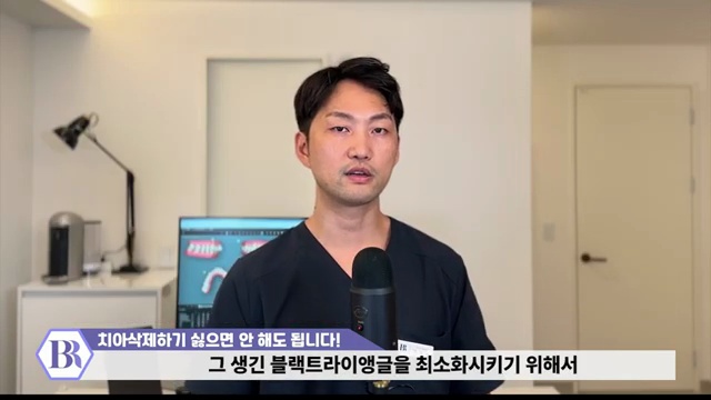 치아삭제 원하지 않으면 하지마세요!