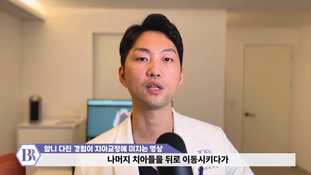 치아교정 진행이 안된다?! 치아가 뼈에 붙는 유착치!