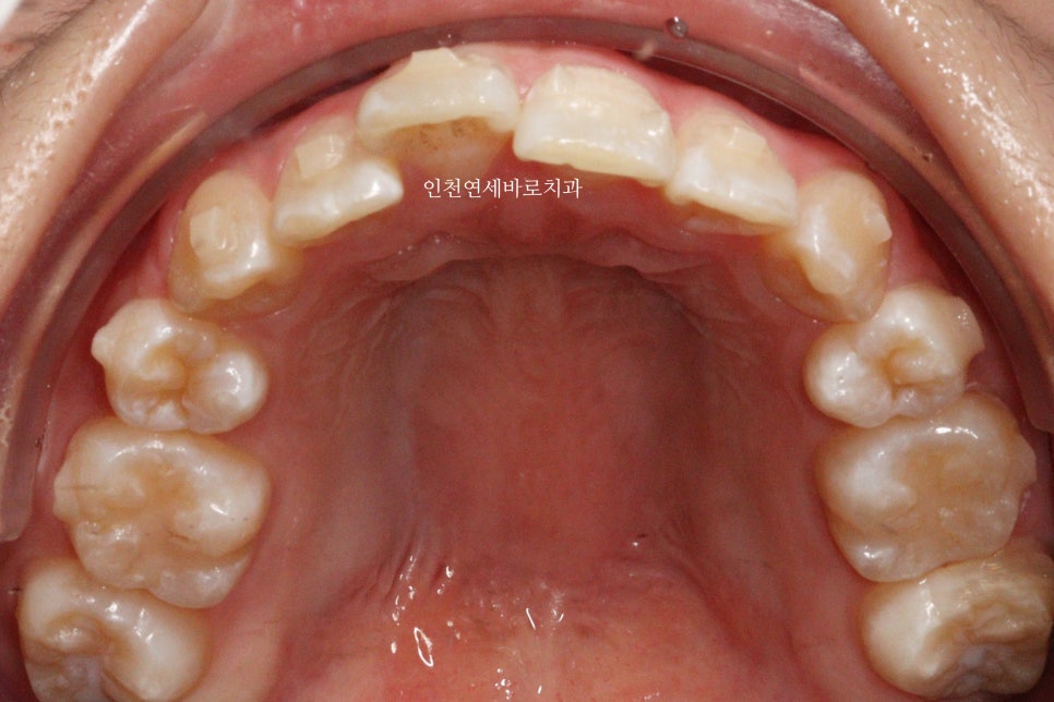 재교정을 해야하는 경우? 그리고 재교정을 위한 방법 및 기간 에 대한 글