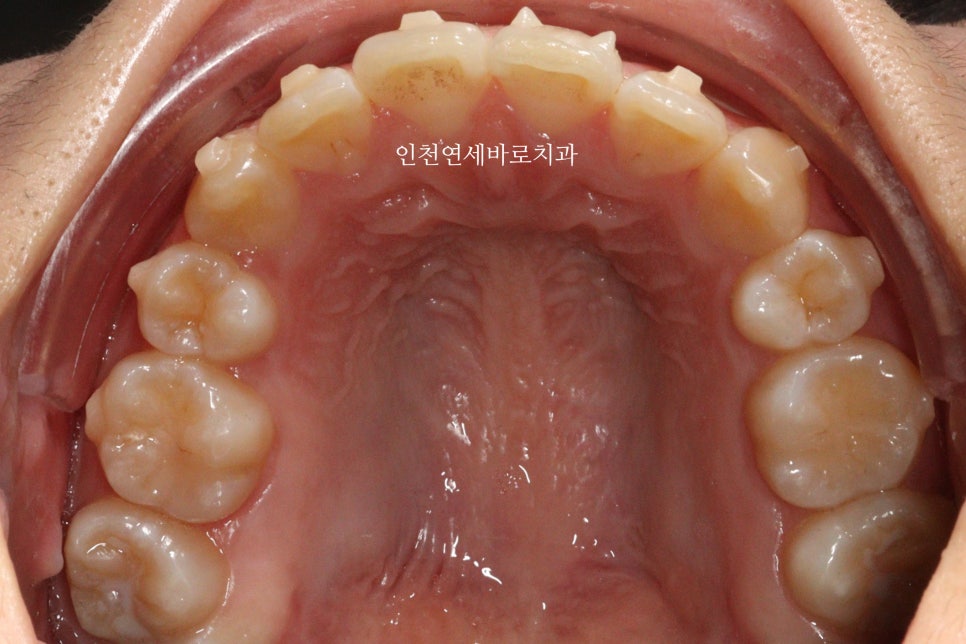 재교정을 해야하는 경우? 그리고 재교정을 위한 방법 및 기간 에 대한 글