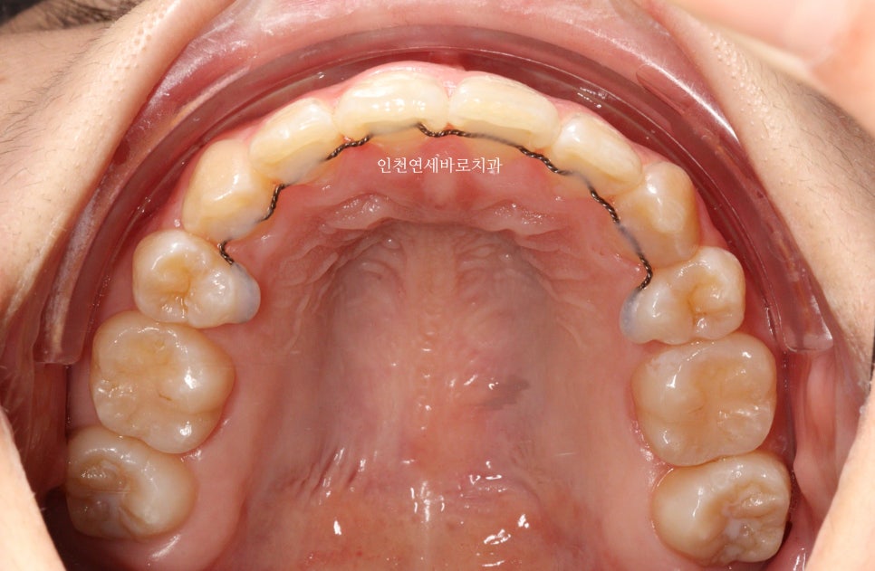 재교정을 해야하는 경우? 그리고 재교정을 위한 방법 및 기간 에 대한 글