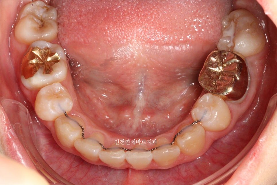 재교정을 해야하는 경우? 그리고 재교정을 위한 방법 및 기간 에 대한 글