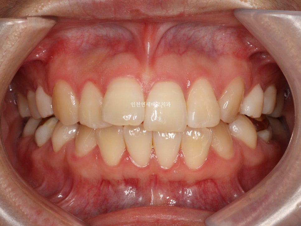 재교정을 해야하는 경우? 그리고 재교정을 위한 방법 및 기간 에 대한 글