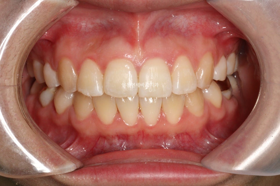 재교정을 해야하는 경우? 그리고 재교정을 위한 방법 및 기간 에 대한 글