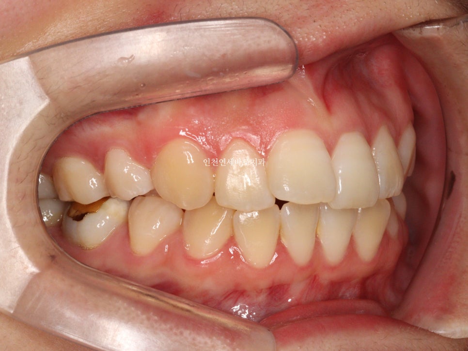 재교정을 해야하는 경우? 그리고 재교정을 위한 방법 및 기간 에 대한 글