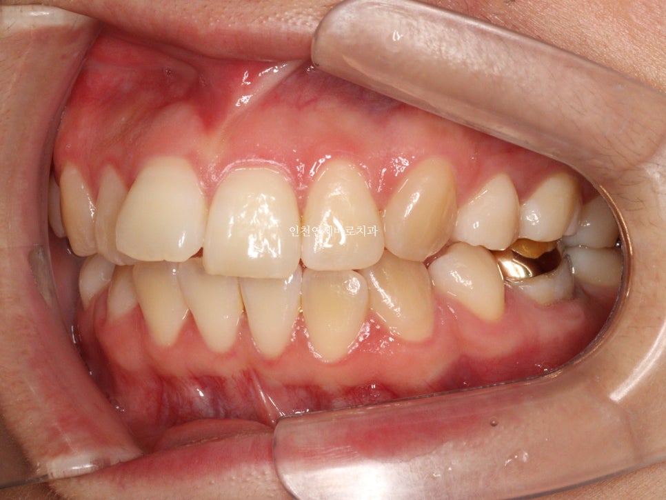 재교정을 해야하는 경우? 그리고 재교정을 위한 방법 및 기간 에 대한 글