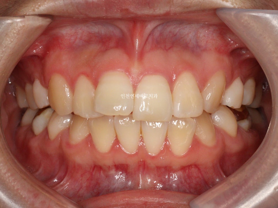 재교정을 해야하는 경우? 그리고 재교정을 위한 방법 및 기간 에 대한 글