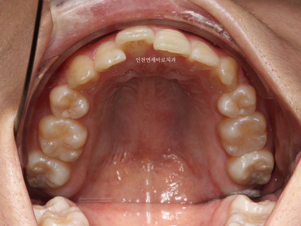 재교정을 해야하는 경우? 그리고 재교정을 위한 방법 및 기간 에 대한 글