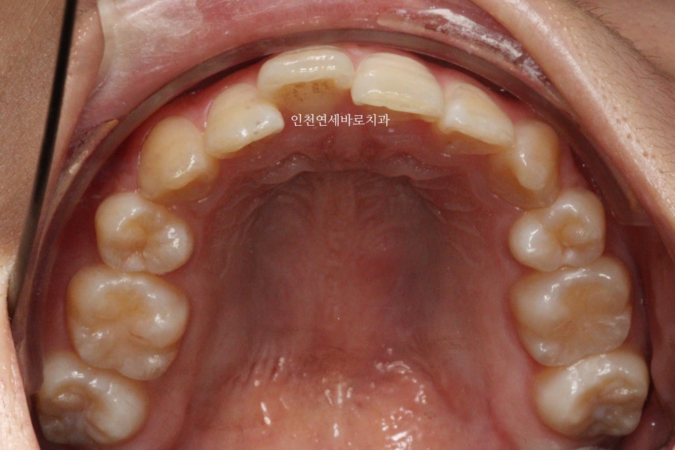 재교정을 해야하는 경우? 그리고 재교정을 위한 방법 및 기간 에 대한 글