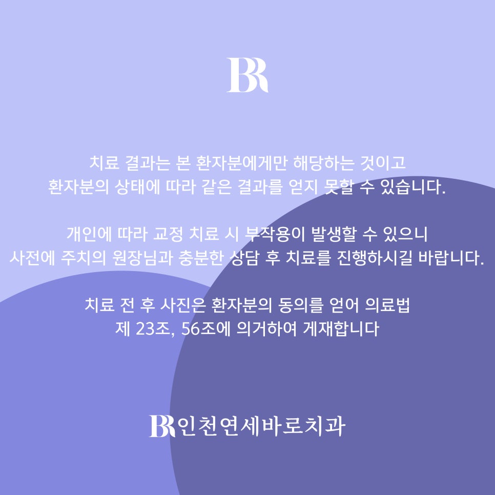 인비절라인 비발치 덧니 교정치료 후기 전후 비교