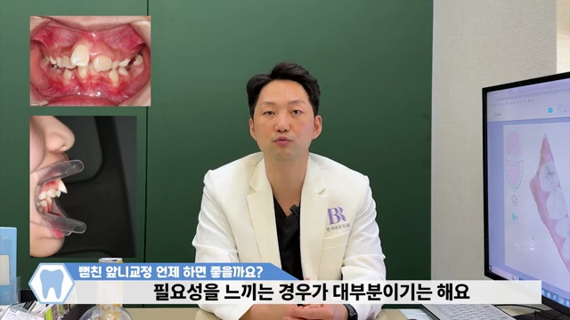 우리아이 뻗친 앞니 교정방법과 교정기간을 알려드립니다!