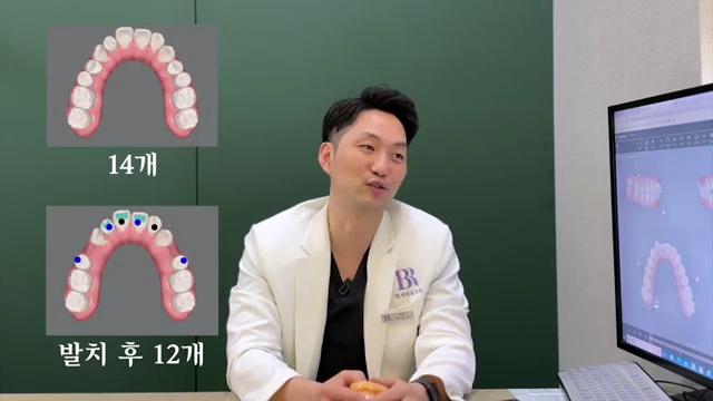 투명교정 인비절라인! 단계별로 아픈 부위가 다르다?!