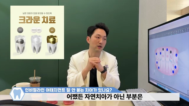 인비절라인 어태치먼트가 자꾸 떨어지는 이유와 해결법