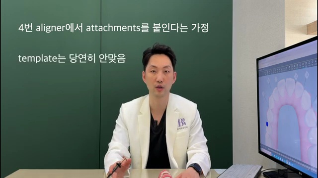치과 위생사 조무사 등 치과 종사자 교육 영상 , 인비절라인 어태치먼트 붙이는 방법