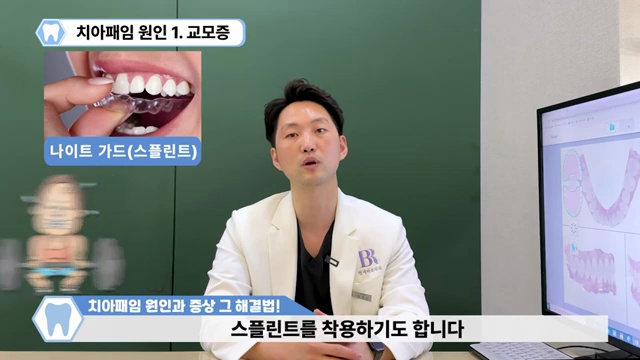 치아패임은 노화현상이 아닙니다!!