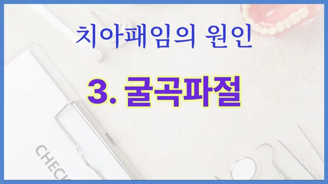치아패임은 노화현상이 아닙니다!!