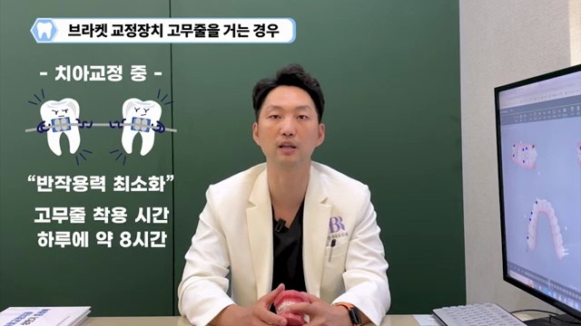 교정치료 중 고무줄 얼마동안 해야 할까?! #치아교정 #고무줄