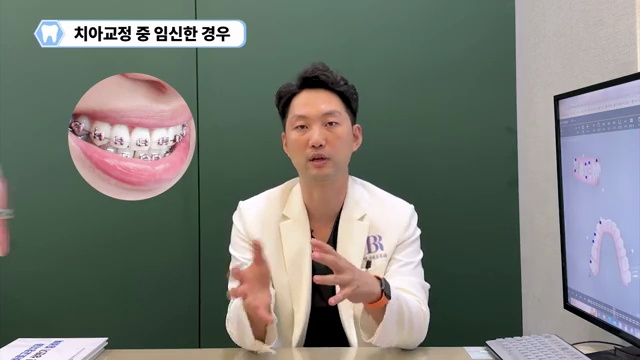 임신하면 치아와 잇몸이 정말 안 좋아질까??? #임신 #치아교정