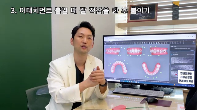치과 위생사 조무사 등 치과종사자 교육 영상2탄, 인비절라인 어태치먼트 떨어졌을 때 주의사항