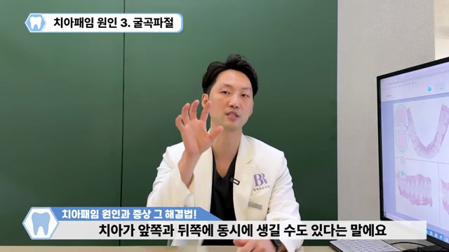 치아패임은 노화현상이 아닙니다!!
