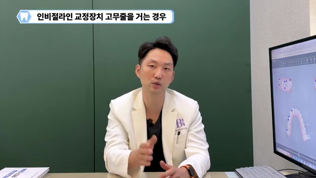 교정치료 중 고무줄 얼마동안 해야 할까?! #치아교정 #고무줄