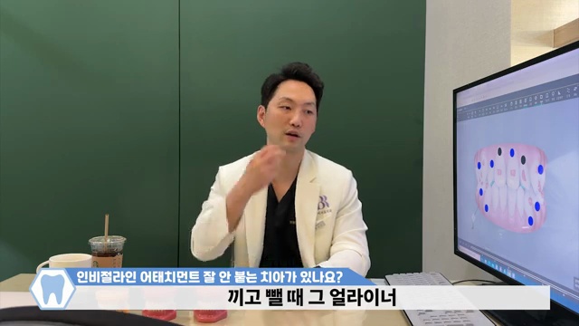 인비절라인 어태치먼트가 자꾸 떨어지는 이유와 해결법
