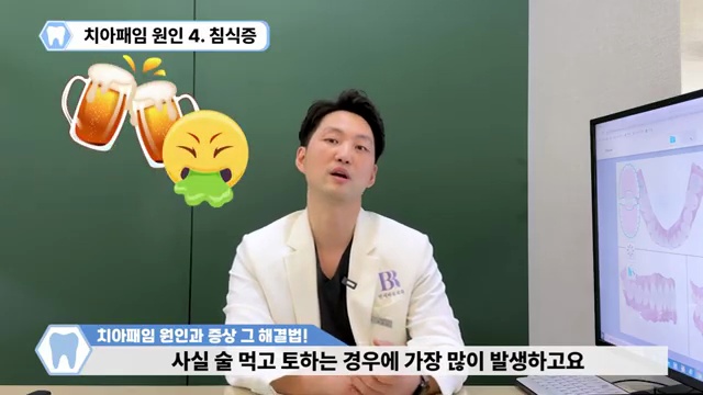 치아패임은 노화현상이 아닙니다!!