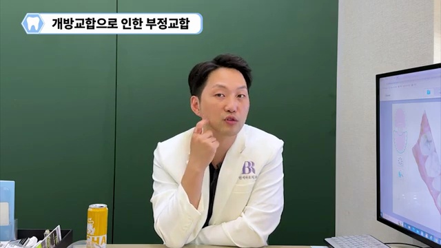 부정교합이신 분들이 치아교정를 해야 하는 이유! #돌출입 #덧니 #주걱턱