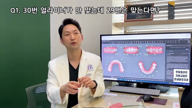 치과 위생사 조무사 등 치과종사자 교육 영상2탄, 인비절라인 어태치먼트 떨어졌을 때 주의사항