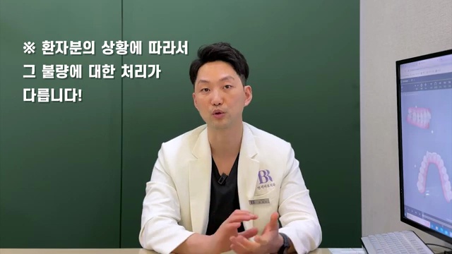 인비절라인 교정장치가 불량일 때 대처 방법│투명교정장치 불량