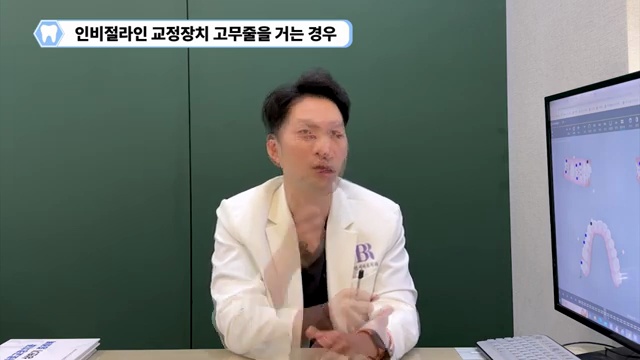 교정치료 중 고무줄 얼마동안 해야 할까?! #치아교정 #고무줄