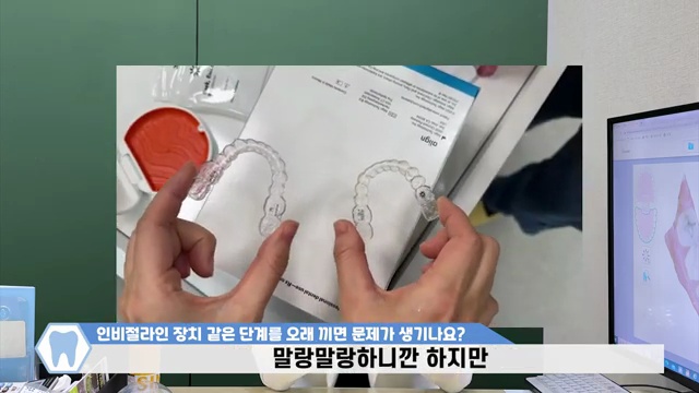 투명교정 인비절라인 장치 한 단계를 오래 끼면 생기는 단점