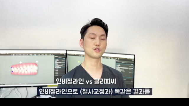 치아교정 장치 선택 인비절라인 / 클리피씨 가장 큰 차이는?