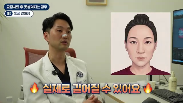 교정했는데 더 못생겨졌다고? 절대 하면 안 되는 3가지 케이스