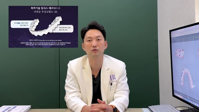 교정치료 중 고무줄 얼마동안 해야 할까?! #치아교정 #고무줄