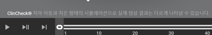 인비절라인 장치 재제작에 대한 모든 것