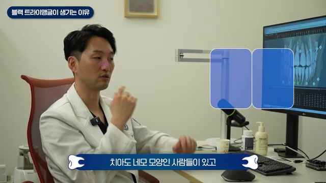교정 부작용 끝판왕, 블랙 트라이앵글 원인과 해결방법