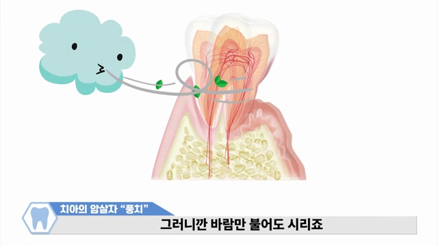 이도 뼈도 사라지는 치아의 암살자! 풍치를 예방하는 방법(with 자가진단법) #풍치 #잇몸약