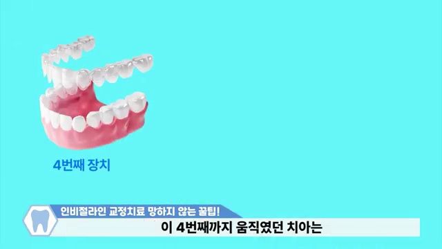 인비절라인 안끼는 사람 보세요
