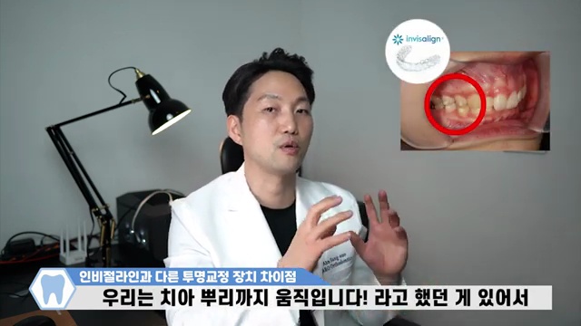 인비절라인 vs 다른 투명교정, 진짜 차이점은? 치과의사가 알려주는 진실