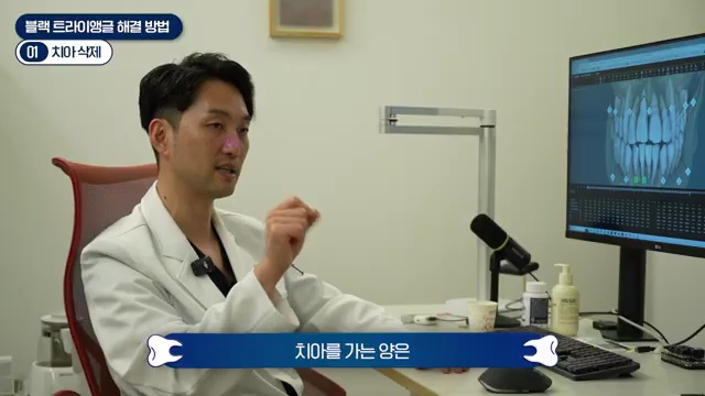 교정 부작용 끝판왕, 블랙 트라이앵글 원인과 해결방법