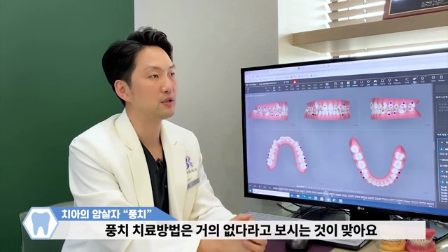 이도 뼈도 사라지는 치아의 암살자! 풍치를 예방하는 방법(with 자가진단법) #풍치 #잇몸약