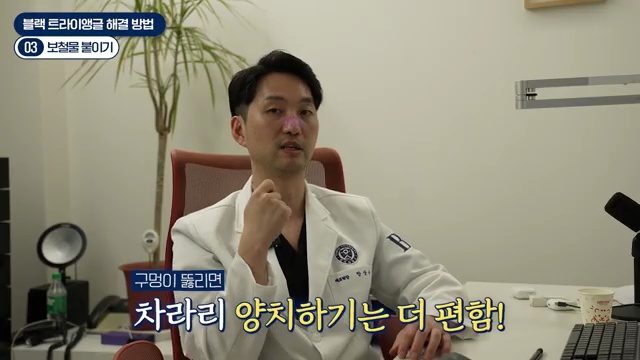 교정 부작용 끝판왕, 블랙 트라이앵글 원인과 해결방법