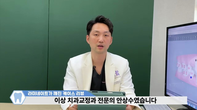 [깨진 라미네이트] 무삭제 라미네이트 재치료 케이스 리뷰! (feat.젤라미)